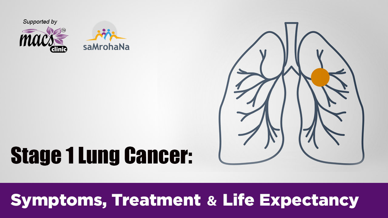 Stage 1 Lung Cancer Symptoms Treatment And Life Expectancy Macs Clinic 1251