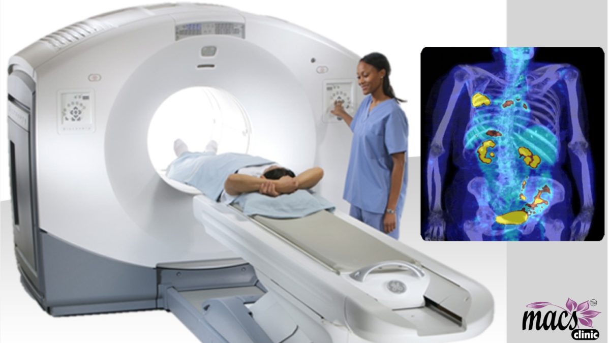Quintessential PET scan does not detect cancer cells.