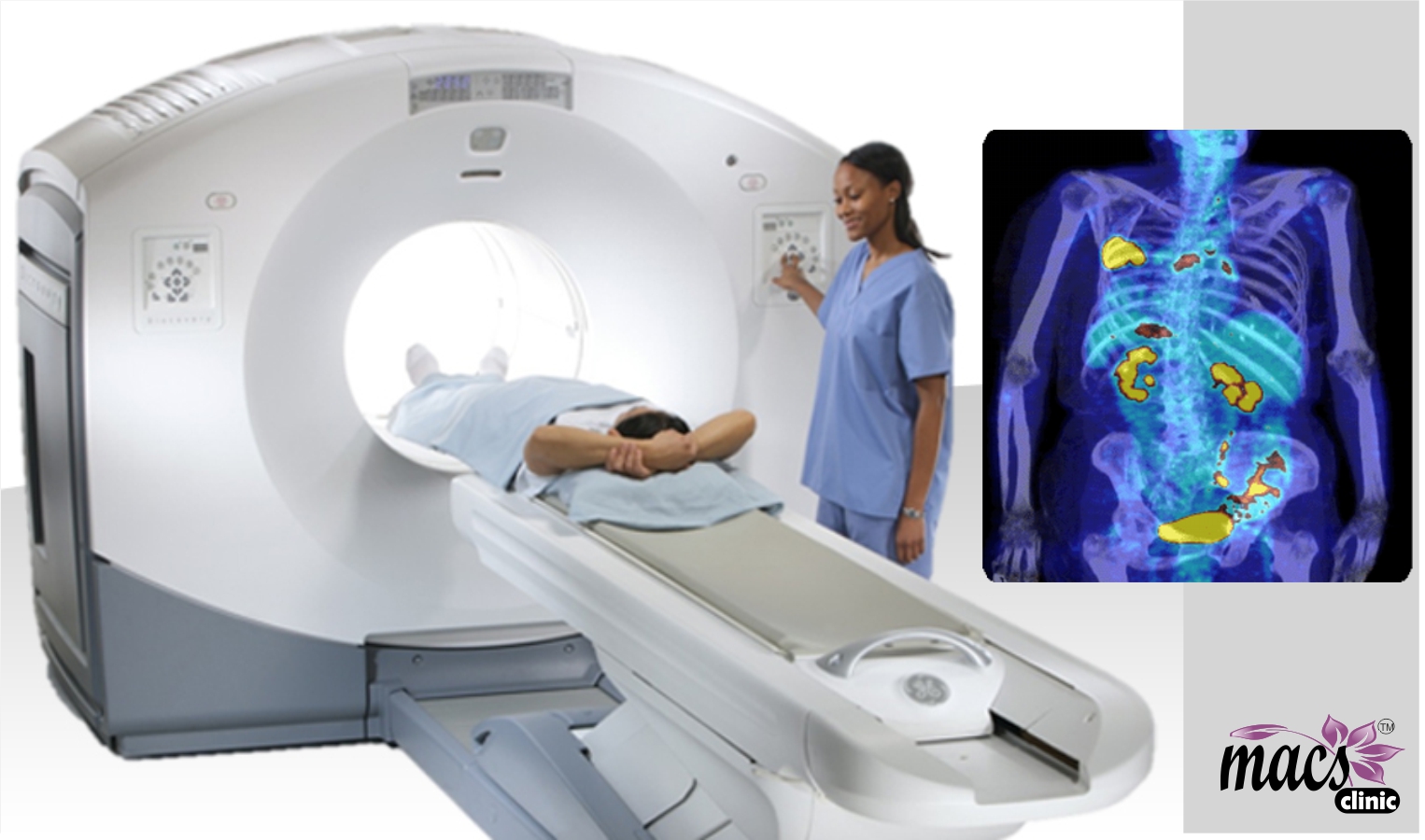 Quintessential PET scan does not detect cancer cells. - Macs Blogs