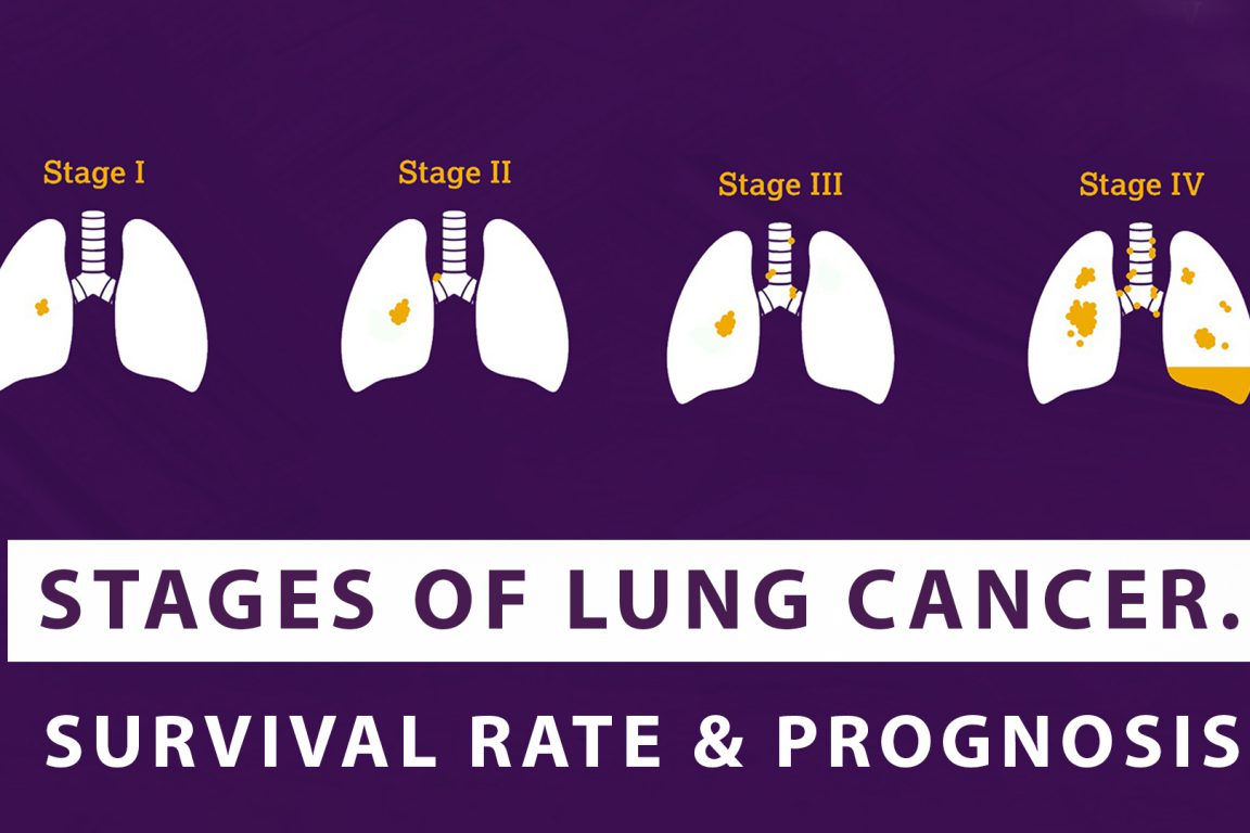 MACS For Cancer Blog | Dr Sandeep Nayak's Blog | About Cancer | MACS ...