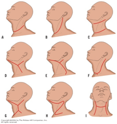 neck dissection