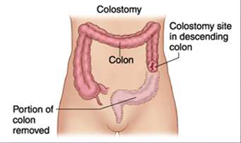 compare-colon