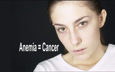 Anemia in Men & Older Women Means Cancer