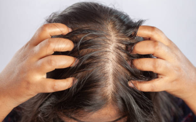 Do All Cancer Chemotherapies Cause Hair Loss?