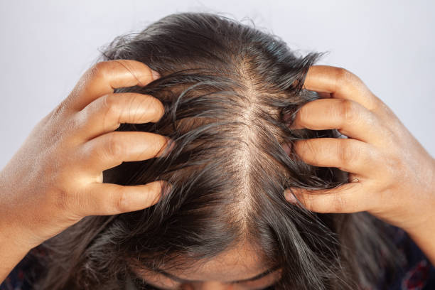 Do All Cancer Chemotherapies Cause Hair Loss?