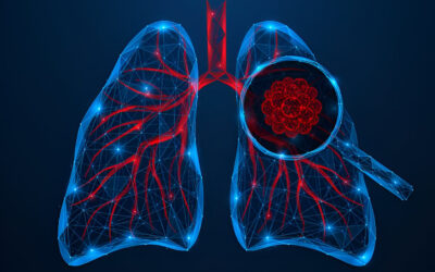 Combining Surgery and Immunotherapy: A New Era for Lung Cancer Patients