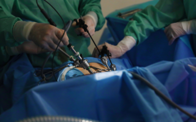 Is Laparoscopy Painful