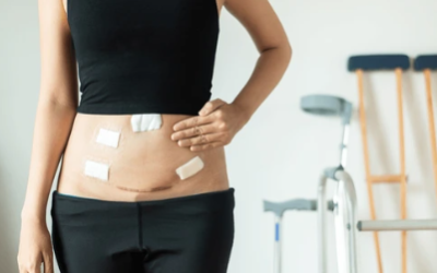 Can I Conceive 2 Months After Laparoscopy?