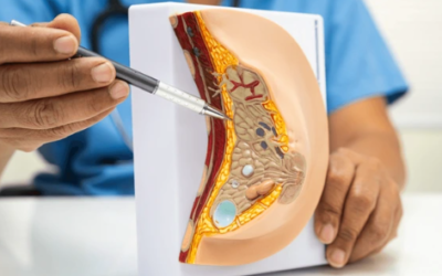 What Is Minimal Access Cancer Surgery?