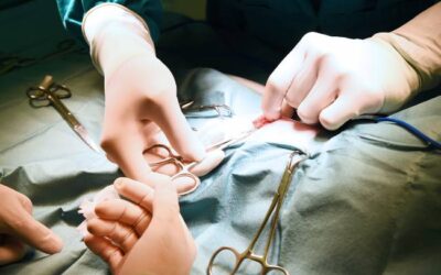 Cytoreductive Surgery for Cancer