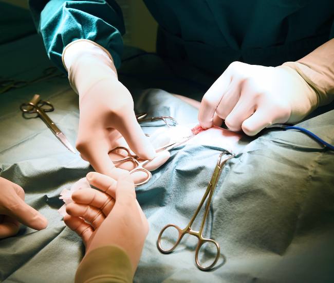 Cytoreductive Surgery for Cancer