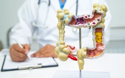 Intersphincteric Resection for Rectal Cancer
