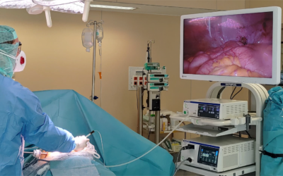 PIPAC Treatment for Peritoneal Cancer