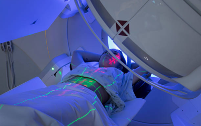 Is Radiation Therapy Safe? Separating Myths from Facts About Radiotherapy