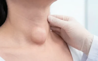 Is a Thyroid Nodule Cancerous?