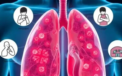 Lung Cancer Signs in Non-Smokers