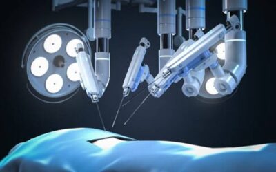 How Is Robotic Surgery Performed Step by Step?