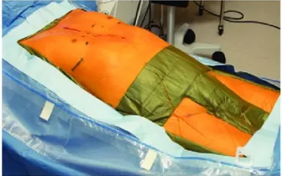 VEIL Procedure for Groin Node Surgery
