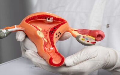 Warning Signs of Ovarian Cancer