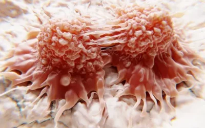 Does Sugar Really Feed Cancer Cells ?