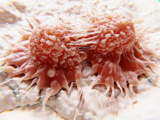 Does Sugar Really Feed Cancer Cells ?