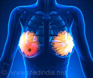 IORT for Breast Cancer: One-Day Radiation Treatment