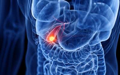 Early Signs of Gallbladder Cancer