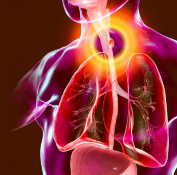 Anatomical illustration of the lungs and trachea, with the airways highlighted by bright colors.