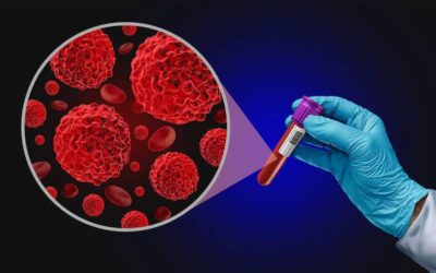 Liquid Biopsy for Cancer Detection