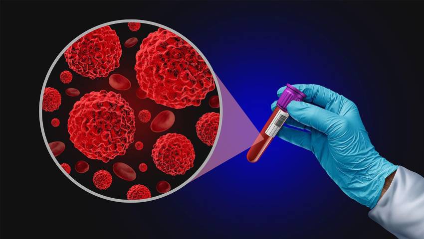 Liquid Biopsy for Cancer Detection