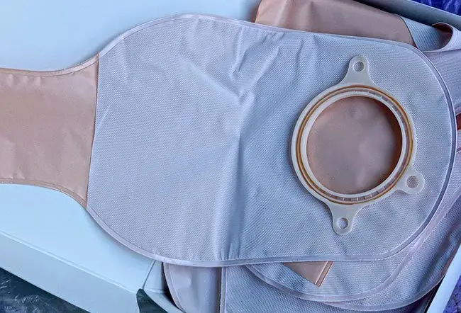 Can You Avoid a Colostomy Bag With Rectal Cancer Surgery MACS Clinic