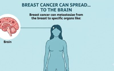Can Breast Cancer Spread to the Brain?