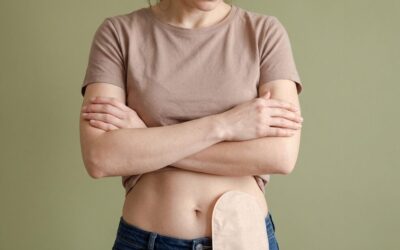 Can a Stoma Bag Be Reversed After Rectal Surgery?