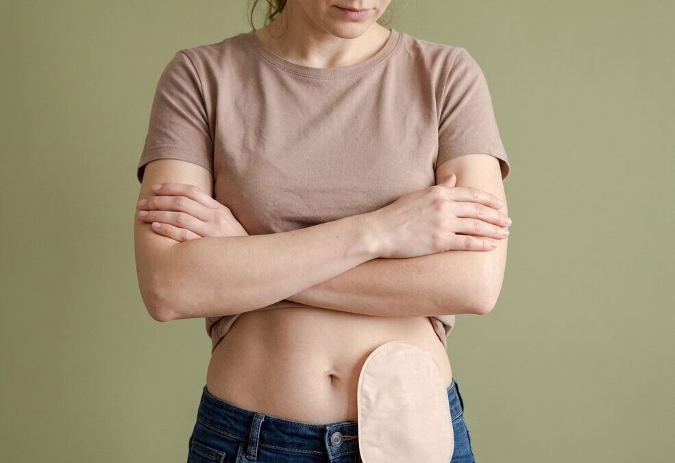 Can a Stoma Bag Be Reversed After Rectal Surgery