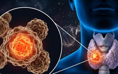 What Is Papillary vs Follicular Thyroid Cancer?