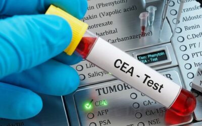 What Is a CEA Blood Test for Colon Cancer