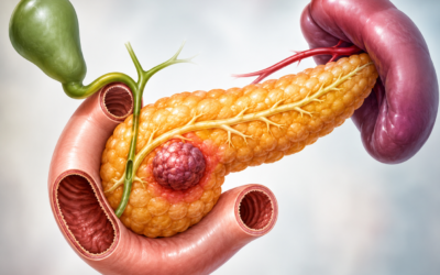 Can Pancreatic Cysts Turn Into Cancer?
