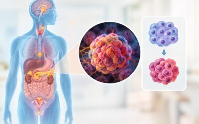 What Is a Neuroendocrine Tumor and Is It a Cancer?