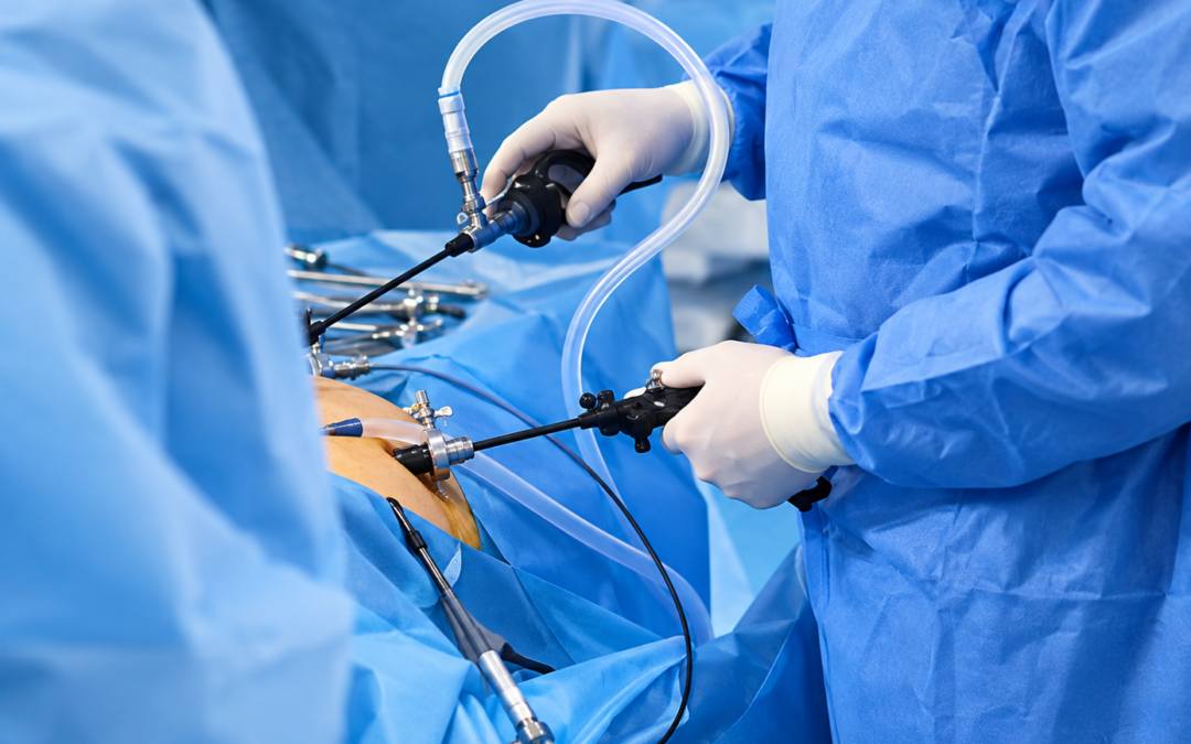 What Is Laparoscopic Cancer Surgery and Is It Effective